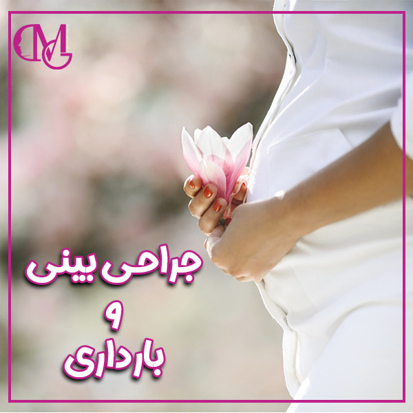جراحی بینی و بارداری - دکتر متین قاضی زاده