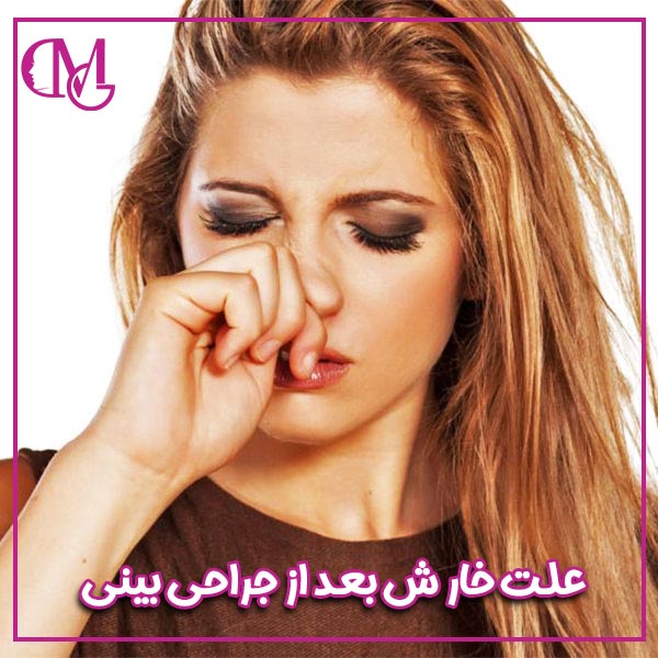 علت خارش بعد از جراحی بینی
