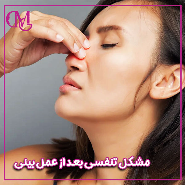 مشکل تنفسی بعد از عمل بینی