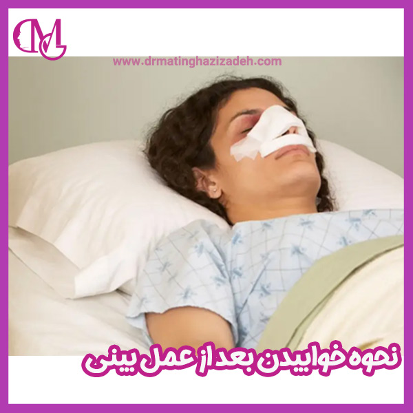 نحوه خوابیدن بعد از عمل بینی